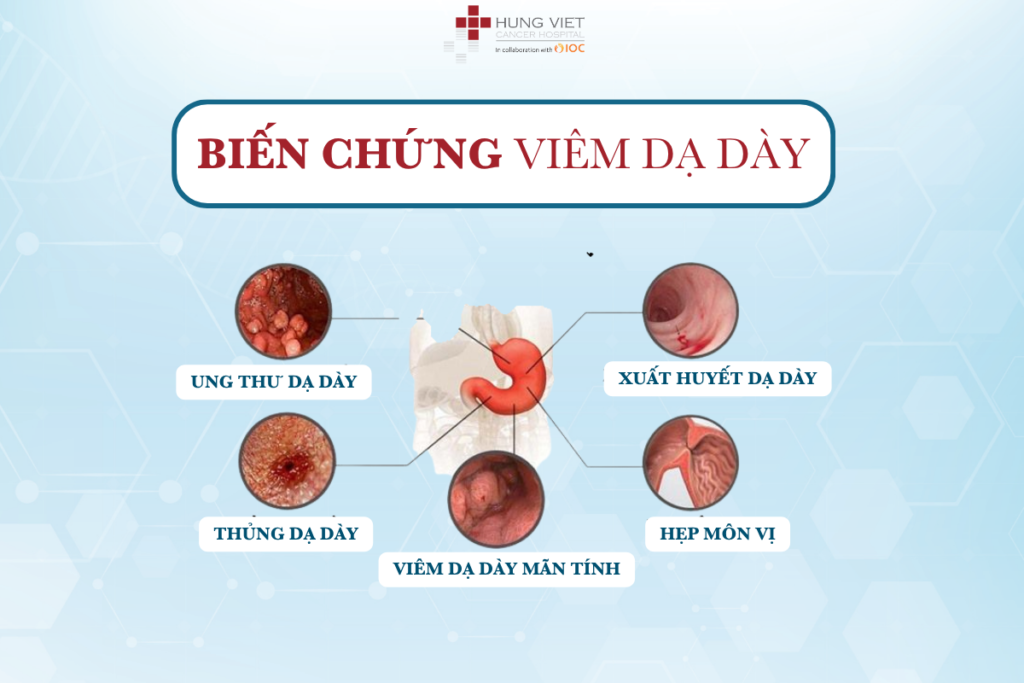 BIẾN CHỨNG VIÊM DẠ DÀY