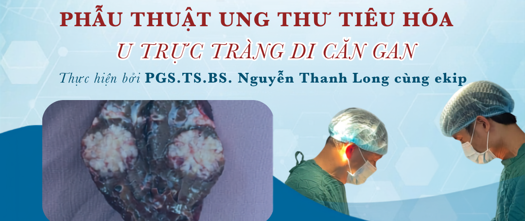 Cắt bỏ khối u trực tràng kèm tổn thương di căn gan trong cùng một cuộc mổ