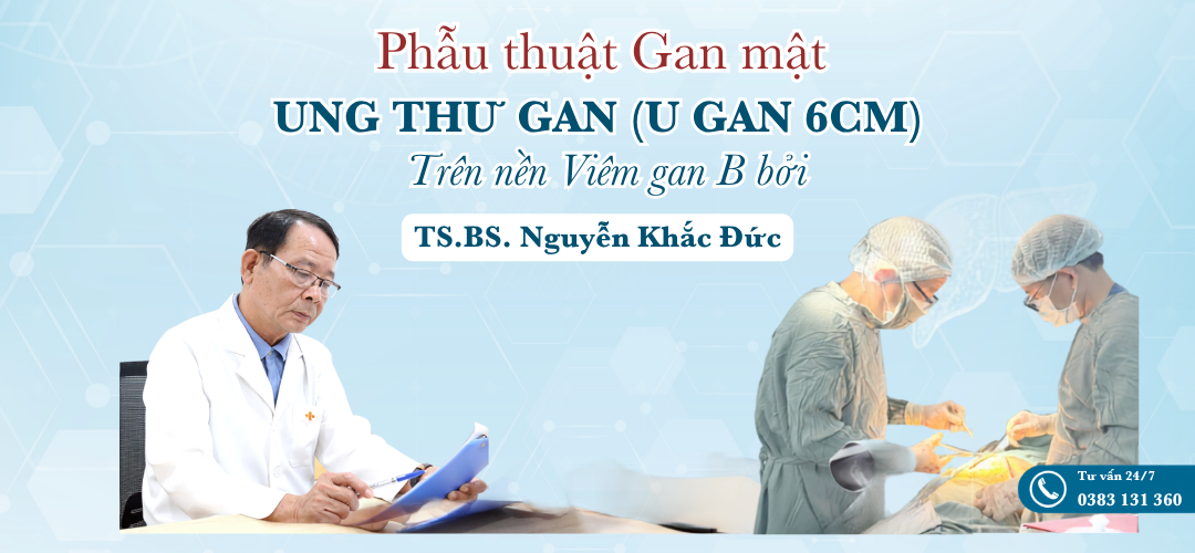 Cắt gan trái bằng dao siêu âm — bảo tồn tối đa nhu mô gan