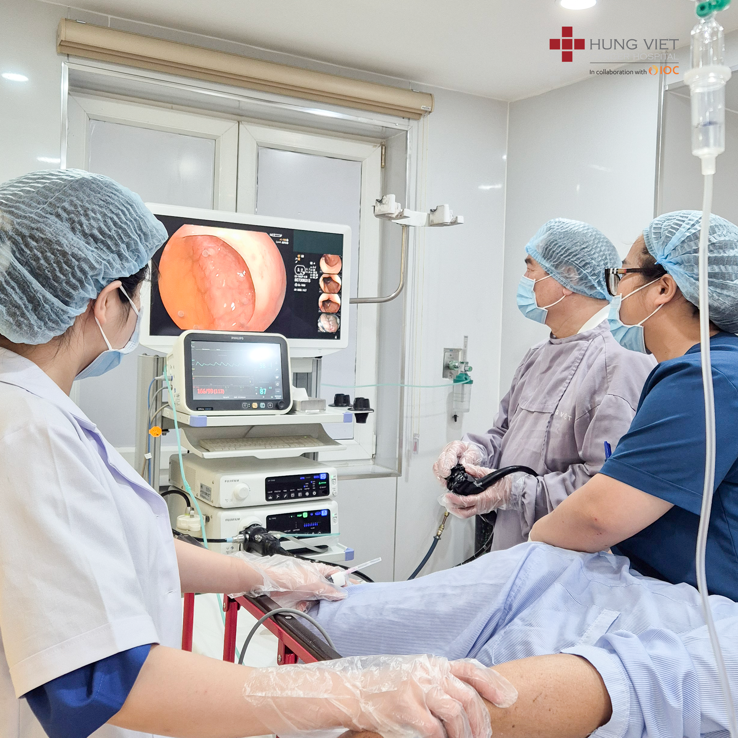XỬ LÝ TRIỆT ĐỂ