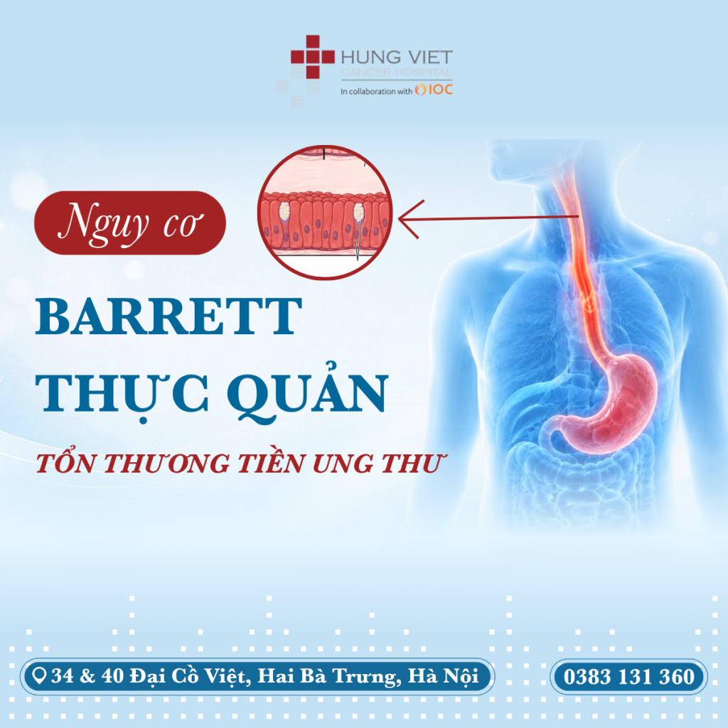 BARETT THỰC QUẢN