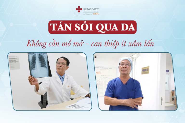 Tán sỏi đường mật qua da